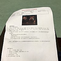 看的出啥情况不😅