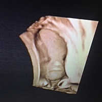 有没有懂的，能不能看看是二胎男孩还是女孩。一胎是男孩👦，谢谢大家……