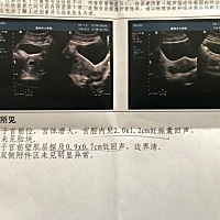 哪位朋友给看一下我这二胎是男宝还是女宝？纯属好奇