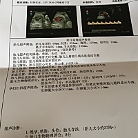 亲们懂得帮忙看看是女孩还是男孩，好做准备啦，