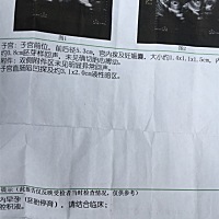 想问大家，这个正常吗？B超医生说没有看到胎心，桑总去打掉