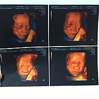 听说思维可以看宝宝性别，好好奇呀！