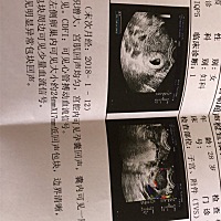 传播正能量，软件显示7周，于是今天去照了B超，结果医生说宝宝实际是6周➕1天，(算算排卵期，也应该差不...