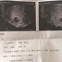 这个能看出男宝女宝嘛？