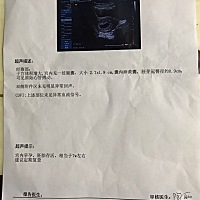 7周了，今天做了B超，有会看是男孩还是女孩吗。