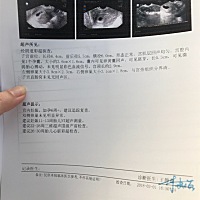 微弱胎心搏动，建设一周复查胎心，好担心，不知道是什么情况，有宝妈们知道什么情况的吗？