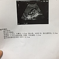 怀孕是不是到三个月比较稳定了啊？我褐色分泌物都流了半个月了，好烦，休息几天不流然后去医院检查走动...