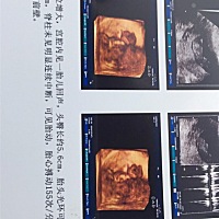 有没有懂的，帮忙看一下男孩女孩，谢谢