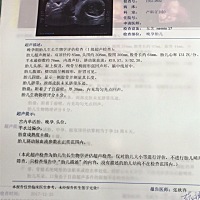 能看出男孩女孩吗？第一胎很好奇男宝女宝🙈