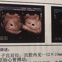 能看出来是男宝 还是女宝吗