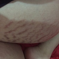 自己看着都吓人🙈