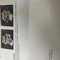 7周3天昨天上厕所有点血丝害怕去医院检查，开的保胎药吃完昨晚肚子老是疼到早上好了，平时偶尔疼一下晚...