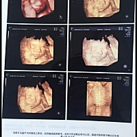 28周胎心143 30周➕5试卡蓝色 晚上跟早晨测试结果一致