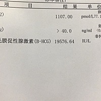 今天6周 1了，毫无孕反。胸少许胀痛。各位孕妈妈你们都是几周去照胎心胎芽的？选择阴超还是腹超呢？附上...