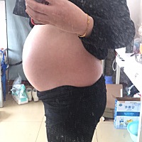 做b超 依旧没看出来男宝女宝 顺其自然嘛 男宝女宝我们都爱