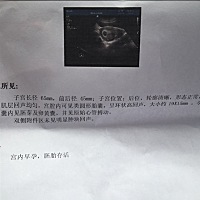 刚做的b超，，医生就照一下下，说话厉害的很，气死我了，姐妹们帮帮忙看下，还没有给医生看，