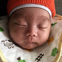 大家看看我儿子脸眉毛干性湿疹是怎么回事？？？