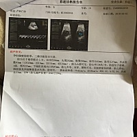 我也是想知道是男孩还是女孩😉😉