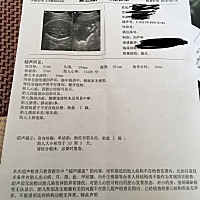 有没有朋友会看男女宝宝的，这个是33周的彩超，目前现在35周啦。
