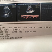 谁能看出是男宝还是女宝哦？