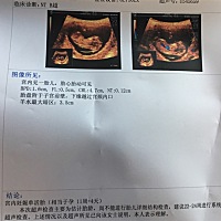 谁会看男宝还是女宝，好奇心太重😄ཽ😄ཽ