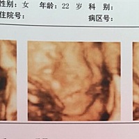 有预产期4月份的准妈妈们吗？咱们也可以弄个群，😄