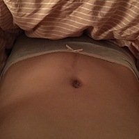 自从怀二宝以来 总感觉肚子一边大一边小 不知道正常否