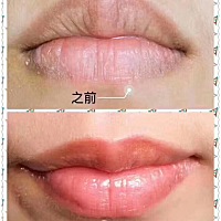 第一次发帖 😜来说说唇部问题。     以前嘴巴一直很干脱皮导致自己很爱用口红去遮唇色 ，结果唇部情况...