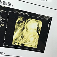 这个算丑的吗？为啥这样看嘴那么大😂😂