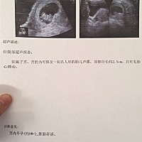 能看出来是男孩还是女孩？