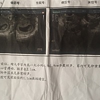 宝妈们帮我看看男女 好奇