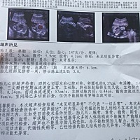 四维顺利通过，第一胎，好奇男女，宝妈们帮忙看看吧