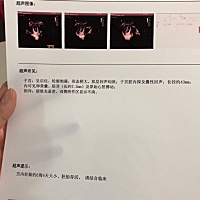 已经能见胎心啦，终于放下心了