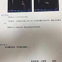 各位宝妈谁能懂帮我看一下男宝还是女宝