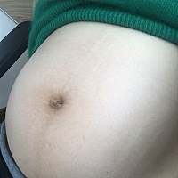 姐妹们帮忙看看是女宝还是男宝，好奇心太强了🙈