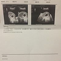 小蝌蚪，猜男🙈