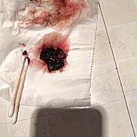 怀孕5周4天，昨天晚上流了一点血，今天早上流了血！中午流出一坨褐色的东西，用棉签拨开里面红红的，这...