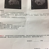 检测有两个囊，一个没有回声，有遇到过此类情况吗