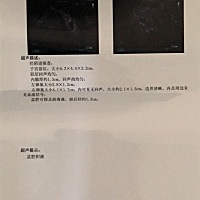 2月12日月经来，开始检测排卵；2月28日出现强阳，去医院做B超检查，医生说排完了？可那个2.2*1.3是什么...