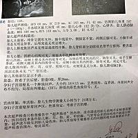 有经验的帮看看是男宝还是女宝呀？好奇呀！