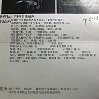 请宝妈们看看孩子一切都健康吧.顺带问问是男宝还是女宝？谢谢🙏大家.请