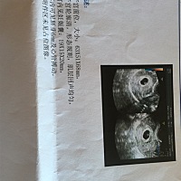 孕六周第二天了。今天去医院做了彩超。但是看不太懂