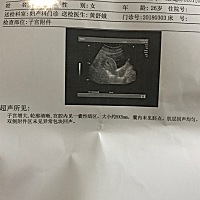 昨天去医院看了医生，医生就开了照B超的单。然后我们排队，排到下午照了B超，结果再拿给那个医生看。谁...