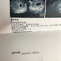 出于好奇，这种胎囊女孩还是男孩的利率大一些，一胎女孩，二胎还想要女孩，不过只要宝宝健康男女都无所...