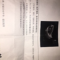 帮我看看要不要紧   大夫说下周复查  孕6周4天
