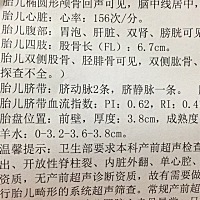 这能看出是男宝还是女宝吗