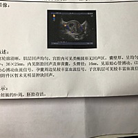 大家会看男宝还是女宝吗？