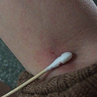 在老公的鼓励下买了张试纸测了下，19号晚上测出来的很不清楚，去抽血才64.多，害怕是生化妊娠或者流产，...