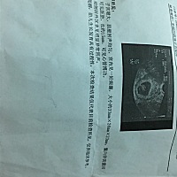 帮忙看一下是男宝还是女宝