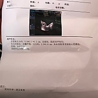 今天去医院做b超，医生竟然都看不到卵黄囊？更别说胎芽跟原始心管搏动了，这是什么情况？是不是情况不好...